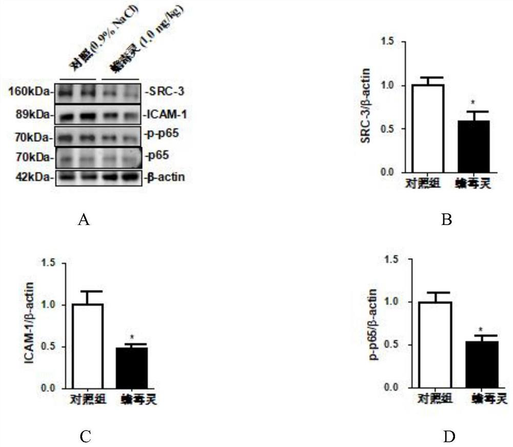 Application of bufalin in preparation of medicine for treating atherosclerosis