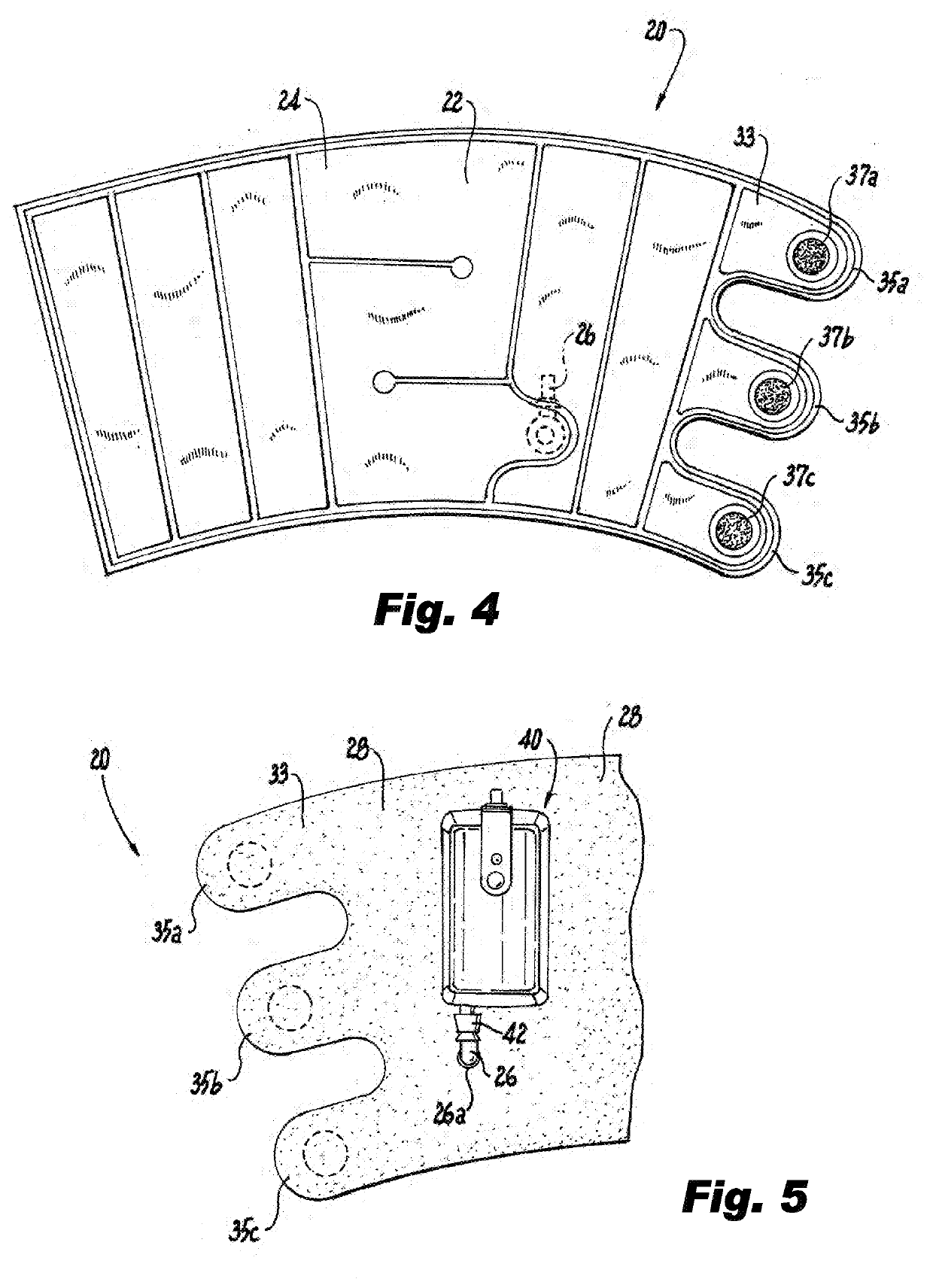 Portable system for the prophylaxis of deep vein thrombosis