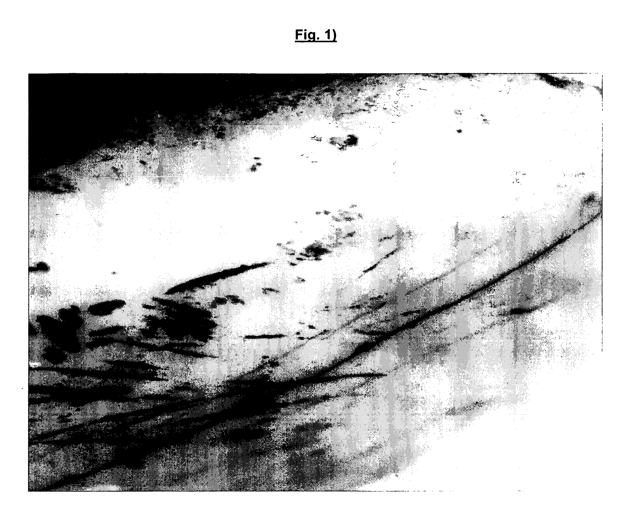Compositions for dental treatment comprising lipoteichoic acids or parts thereof like mono- or polyglycerphosphates
