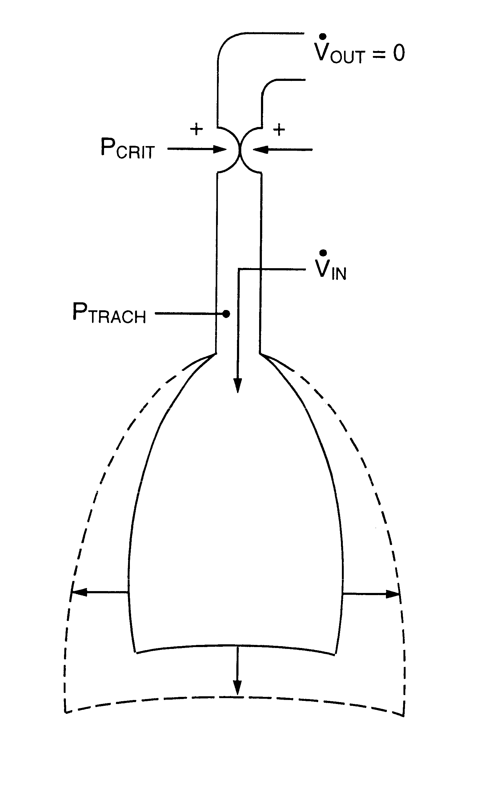 Method and apparatus for providing ventilatory support to a patient