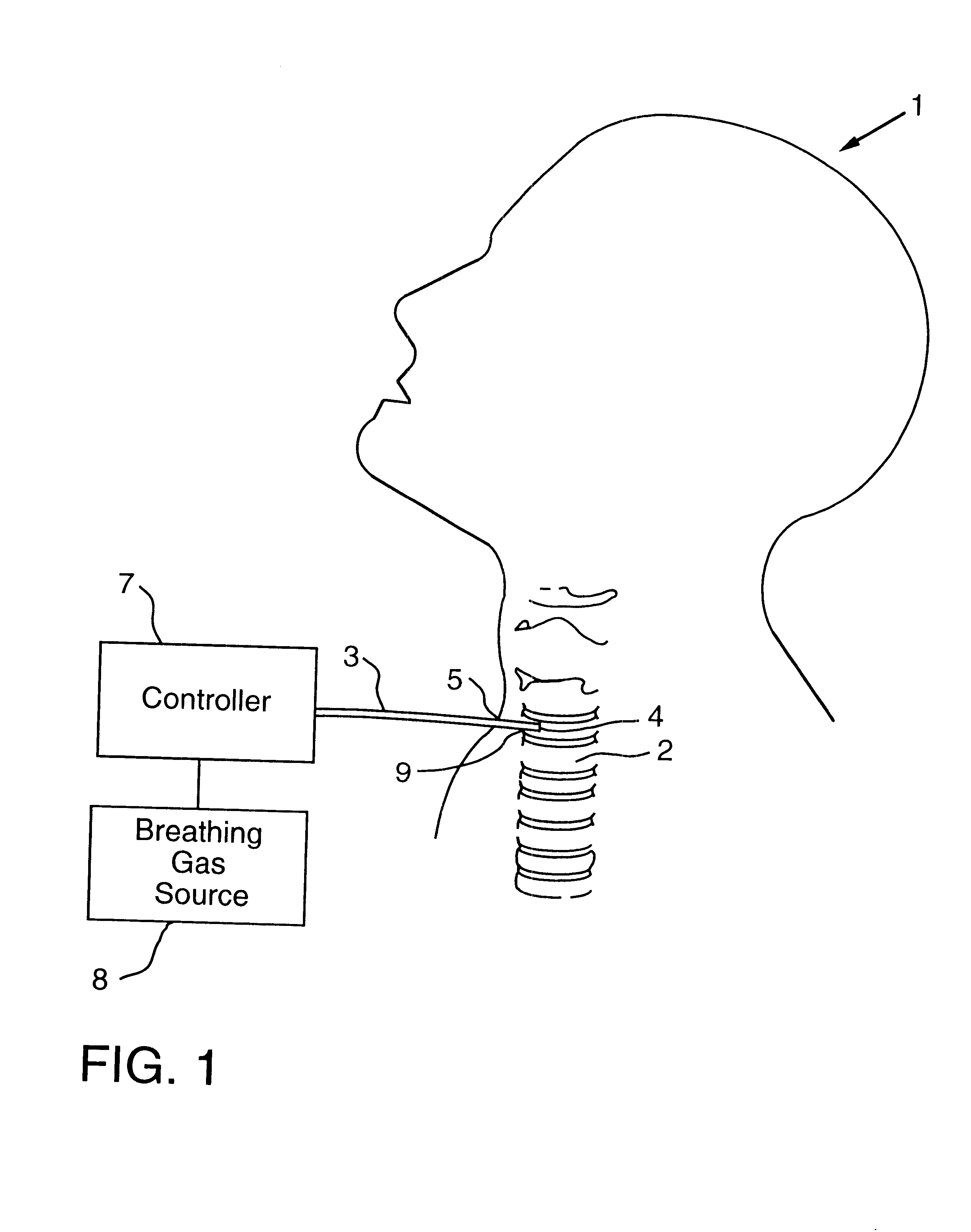 Method and apparatus for providing ventilatory support to a patient