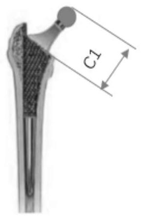 Method and system for determining thighbone length in hip replacement