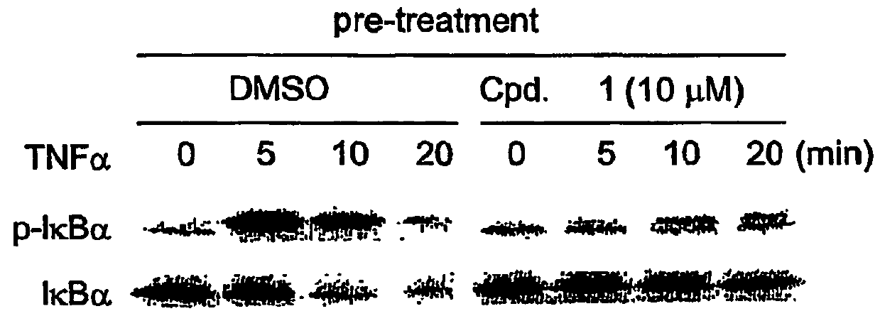 Use of inhibitors of IκB kinase for the treatment of cancer