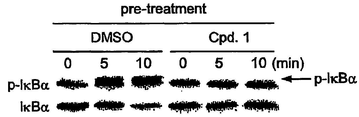 Use of inhibitors of IκB kinase for the treatment of cancer