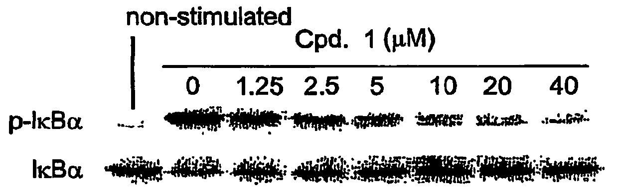 Use of inhibitors of IκB kinase for the treatment of cancer