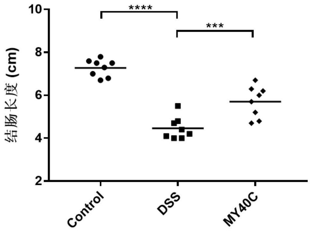 Bifidobacterium pseudocatenulatum capable of relieving colitis and application thereof