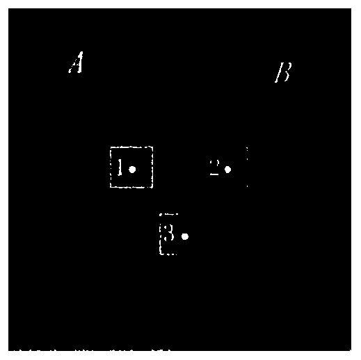 Coherent Speckle Suppression Method for Non-local Mean Radar Image Based on Ratio Distance