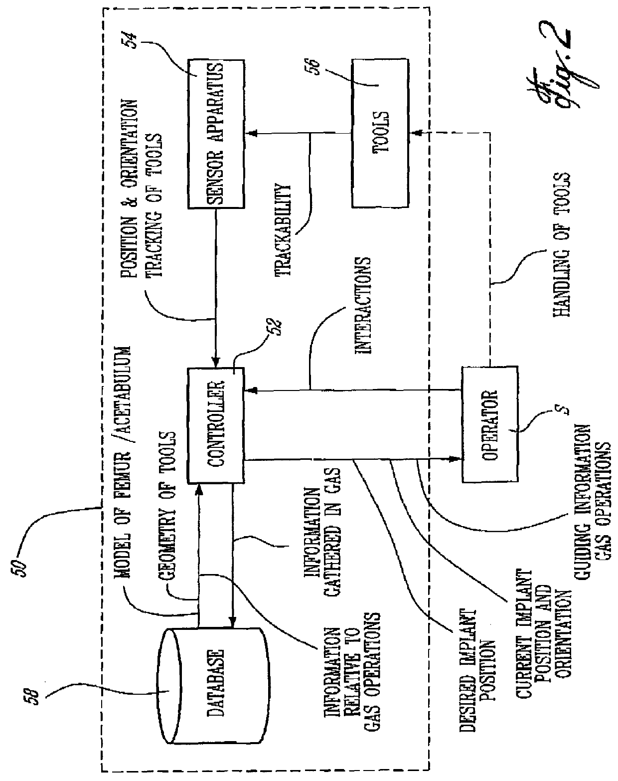 Computer-assisted hip replacement surgery