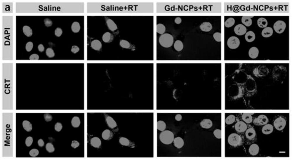 Application of nanoscale coordination polymer Hemin (at) Gd-NCPs