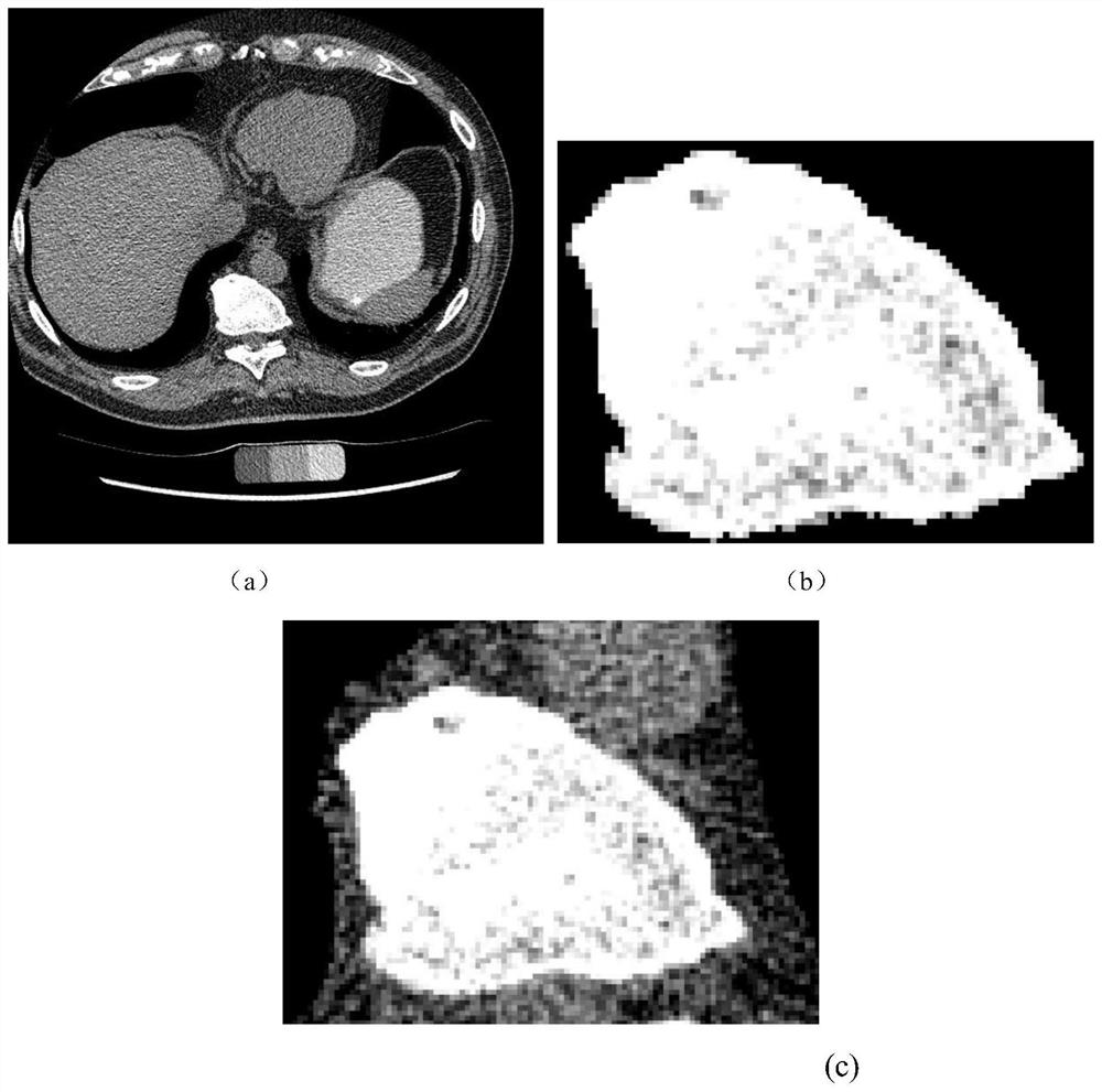 Unsupervised image segmentation method based on Chan-Vse model