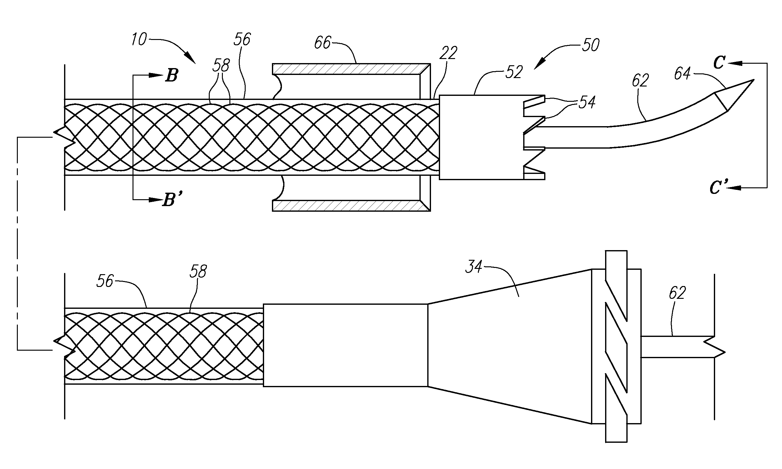 Apparatus and method for treatment of ethmoids