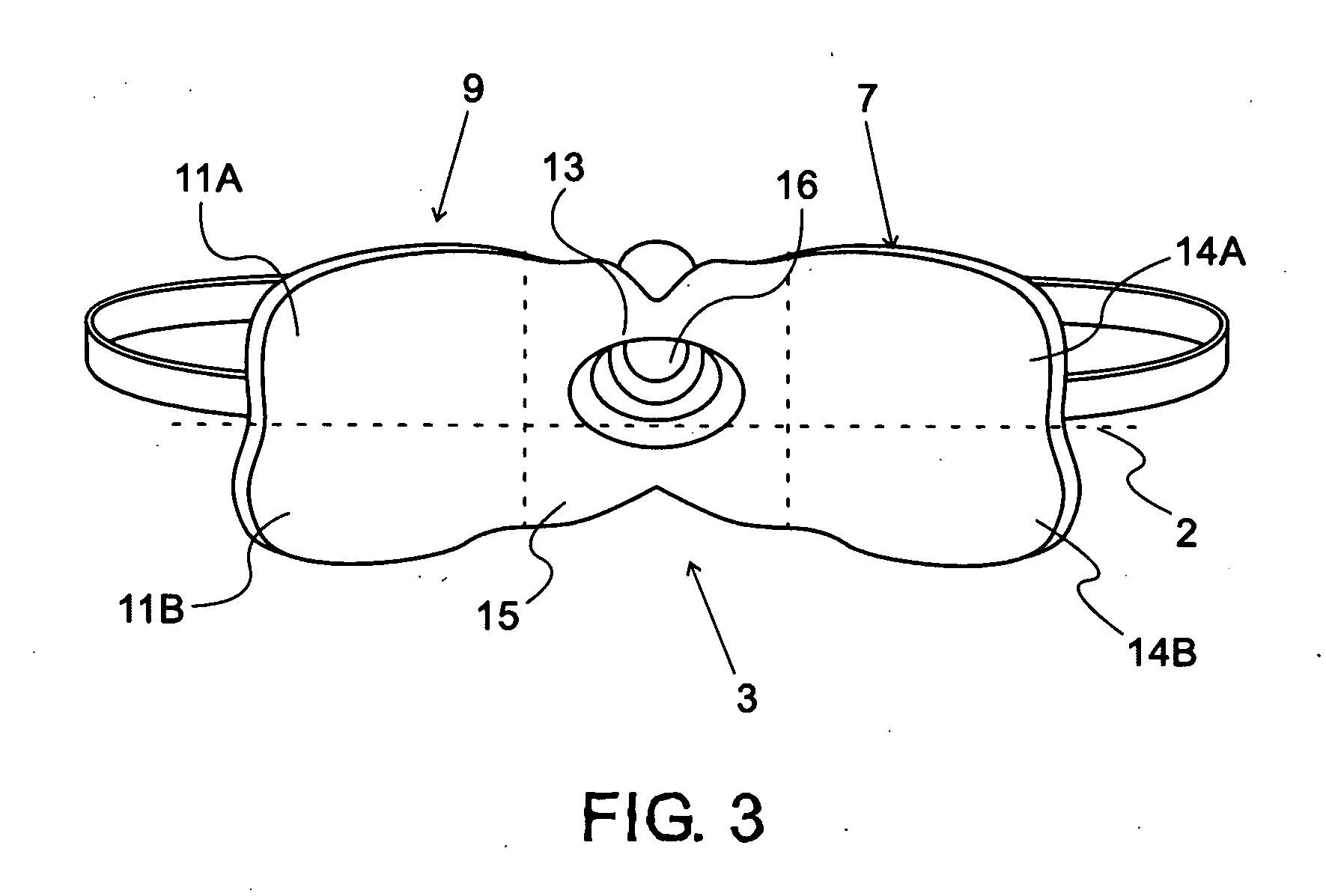 Intraoral cpap interface