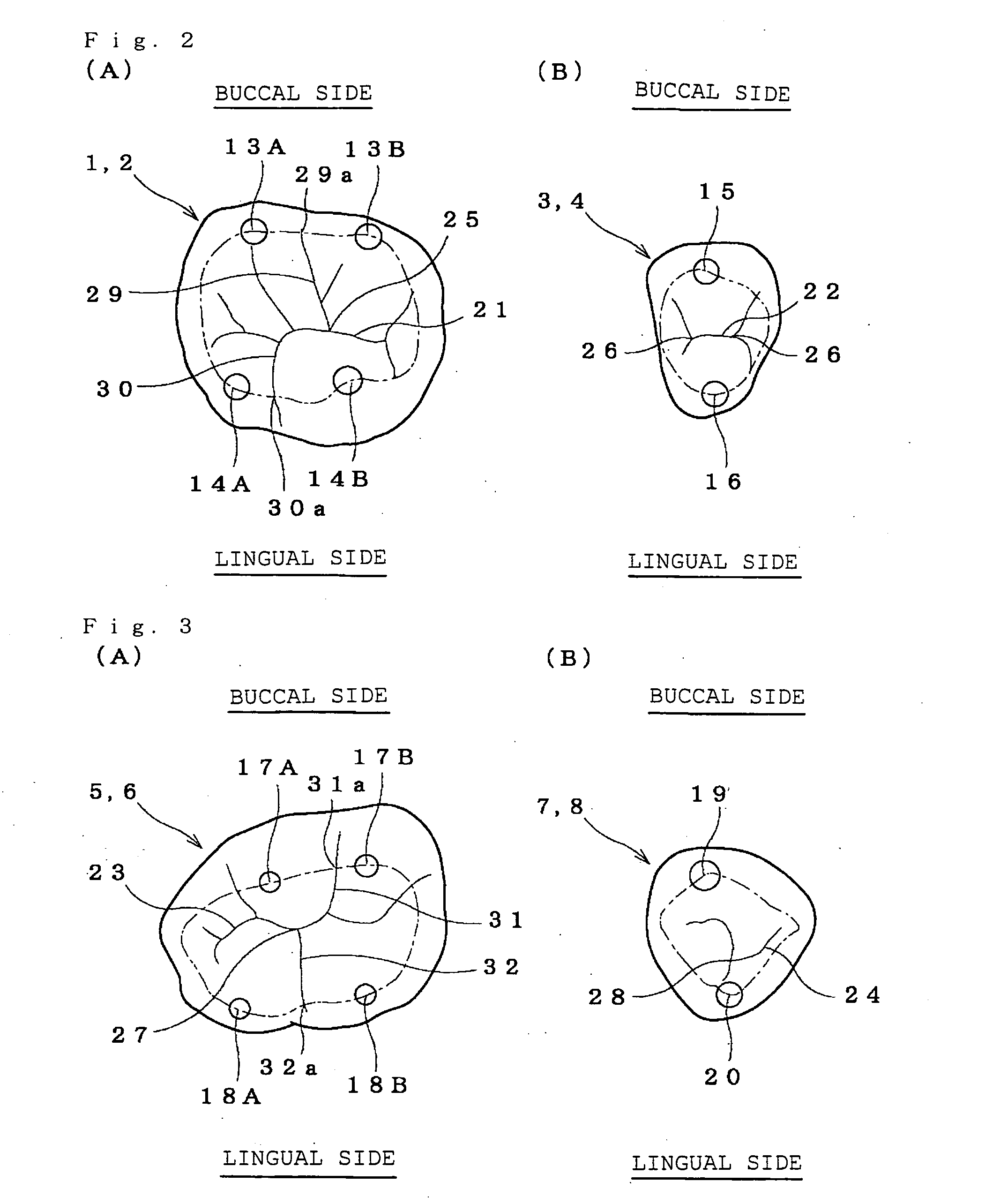 Artificial teeth