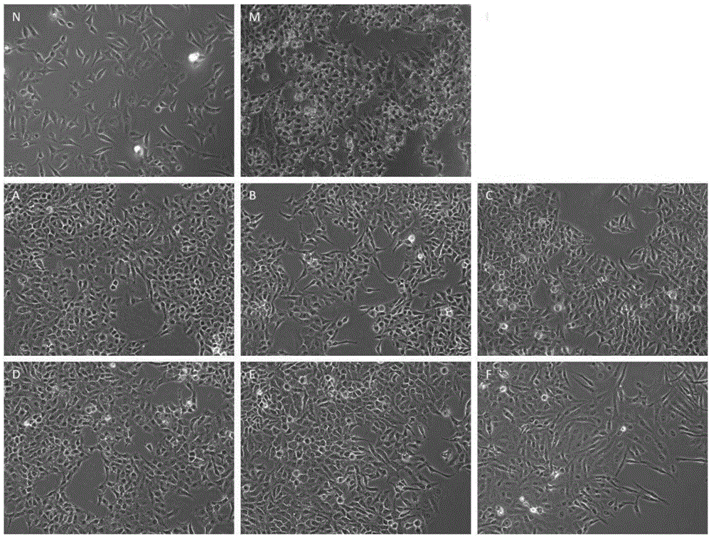 Compound preparation with effective components of traditional Chinese medicine for treating non-alcoholic fatty liver diseases and application of compound preparation