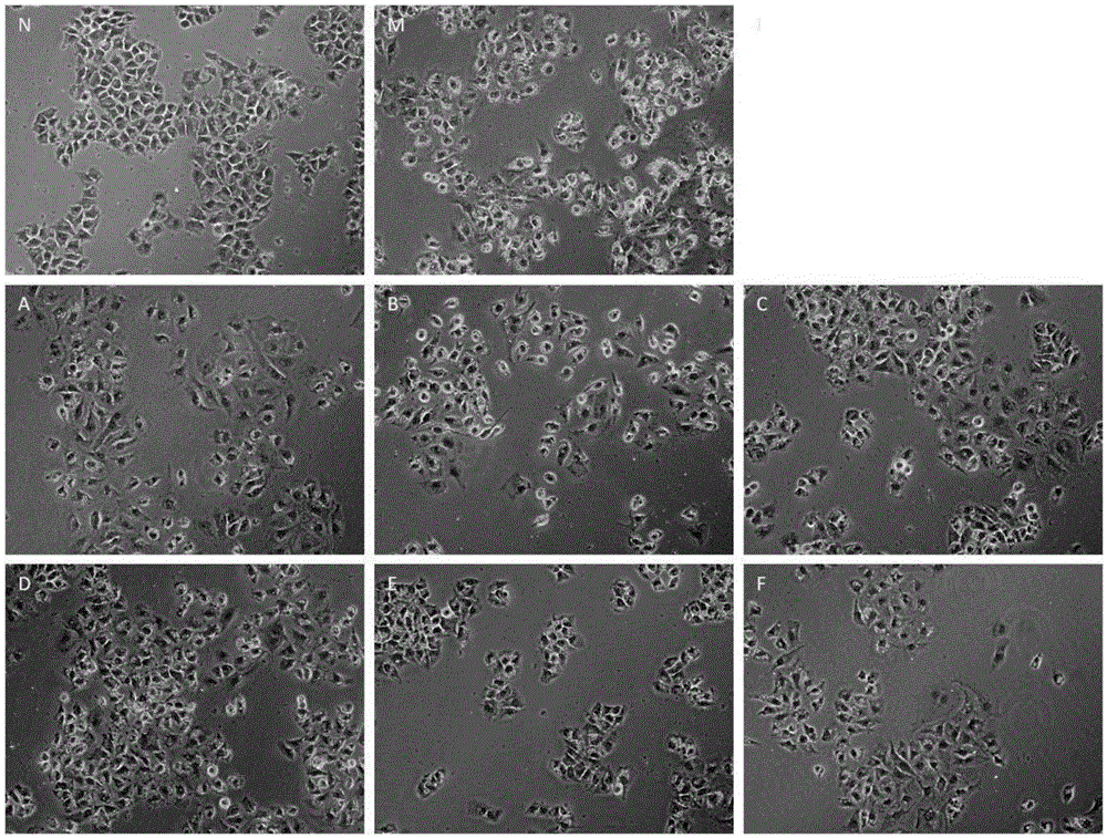 Compound preparation with effective components of traditional Chinese medicine for treating non-alcoholic fatty liver diseases and application of compound preparation