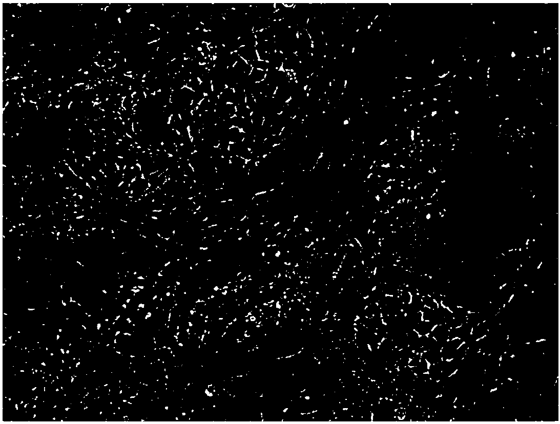 Culture medium for inducing directional differentiation of human embryonic stem cells into liver-like tissue, inducing method and application