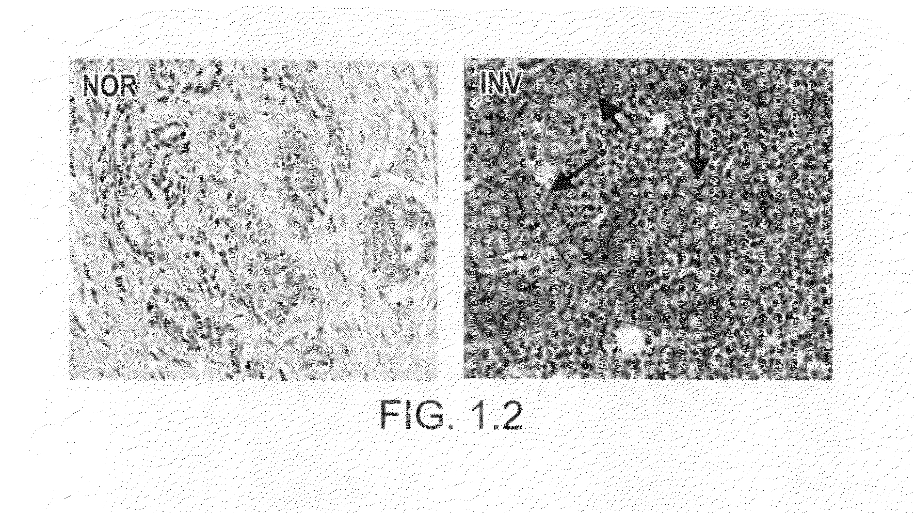 Kinase protein binding inhibitors