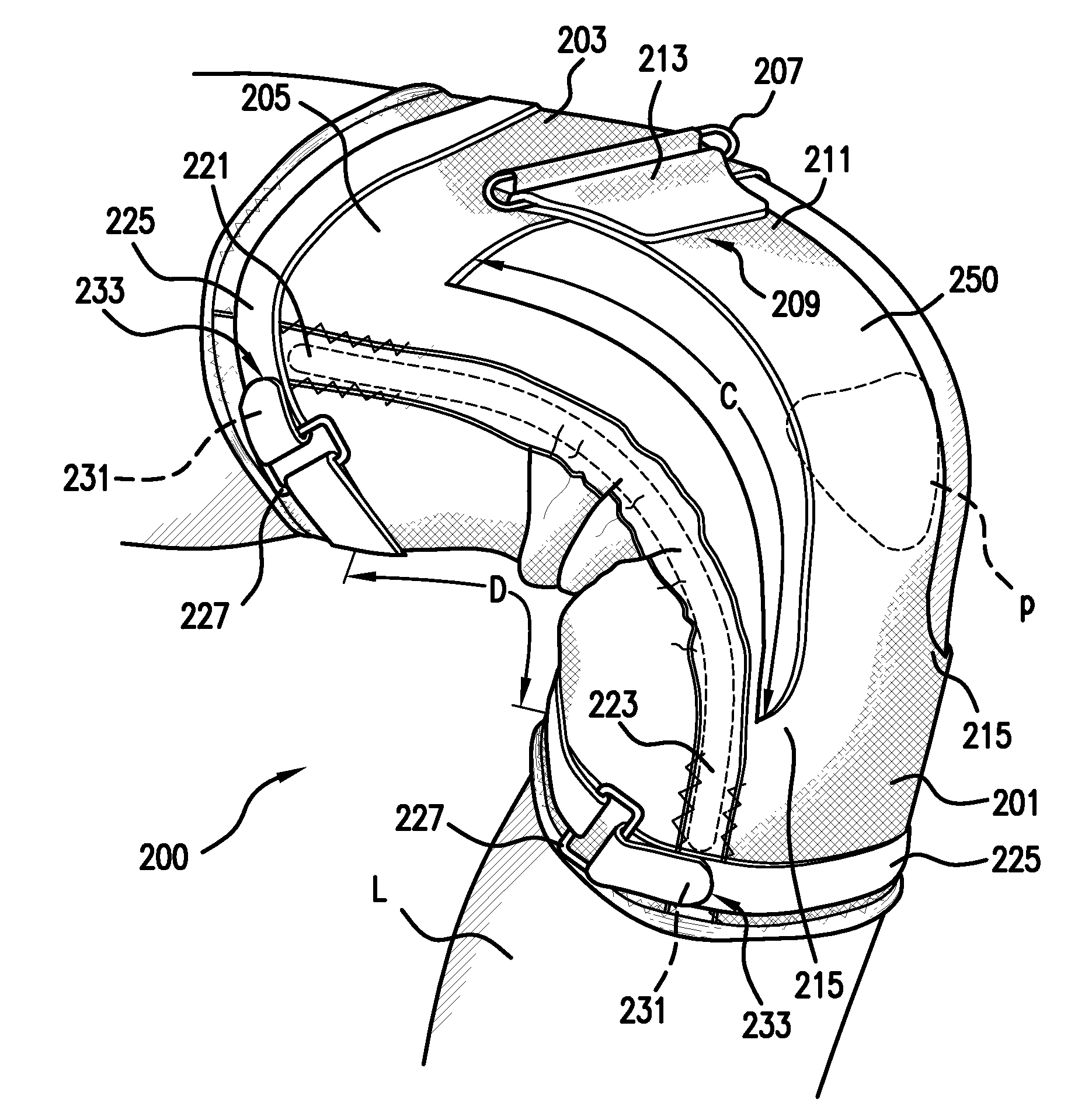 Apparatus for and method of diagnosing and treating patello-femoral misalignment