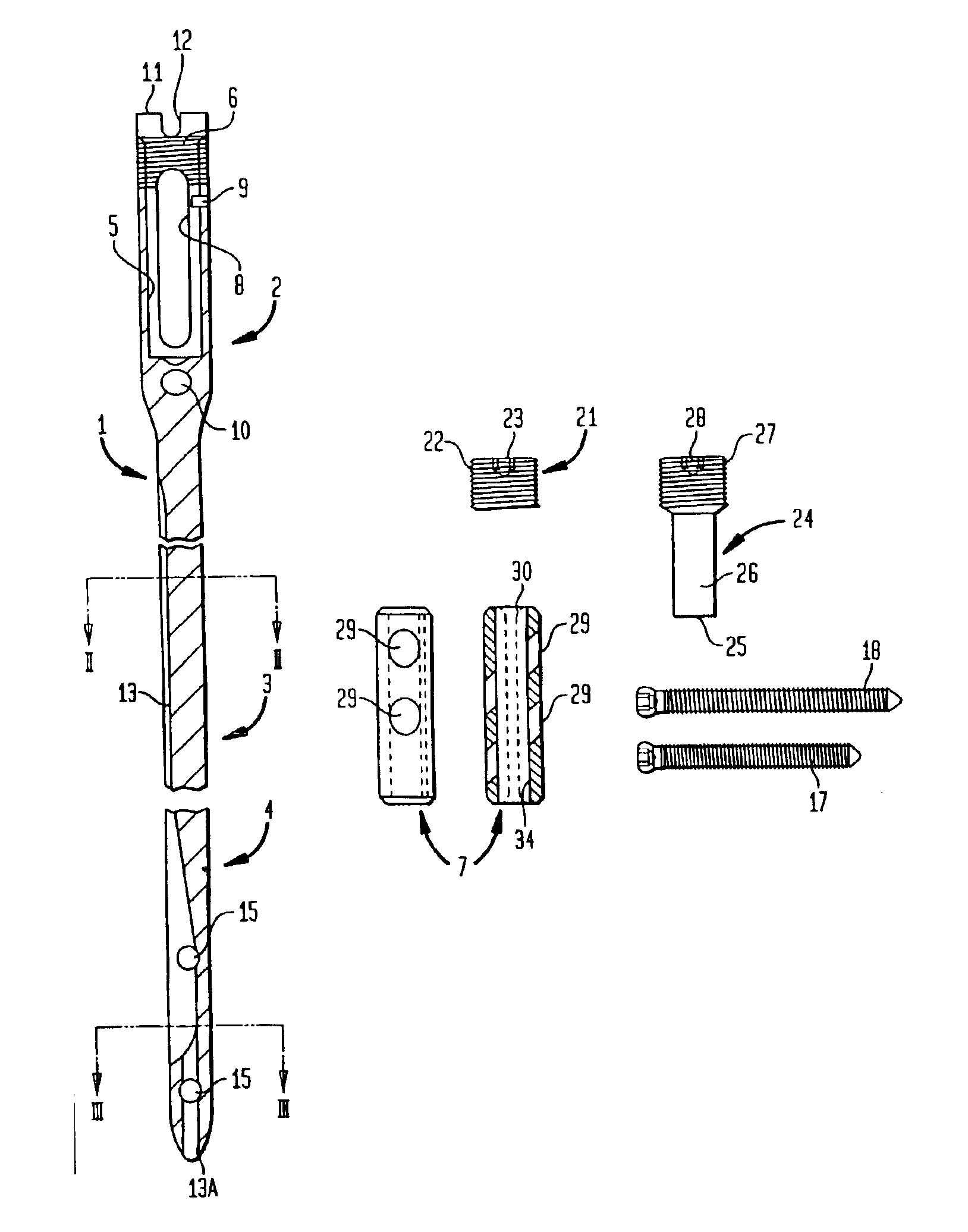 Modular intramedullary nail