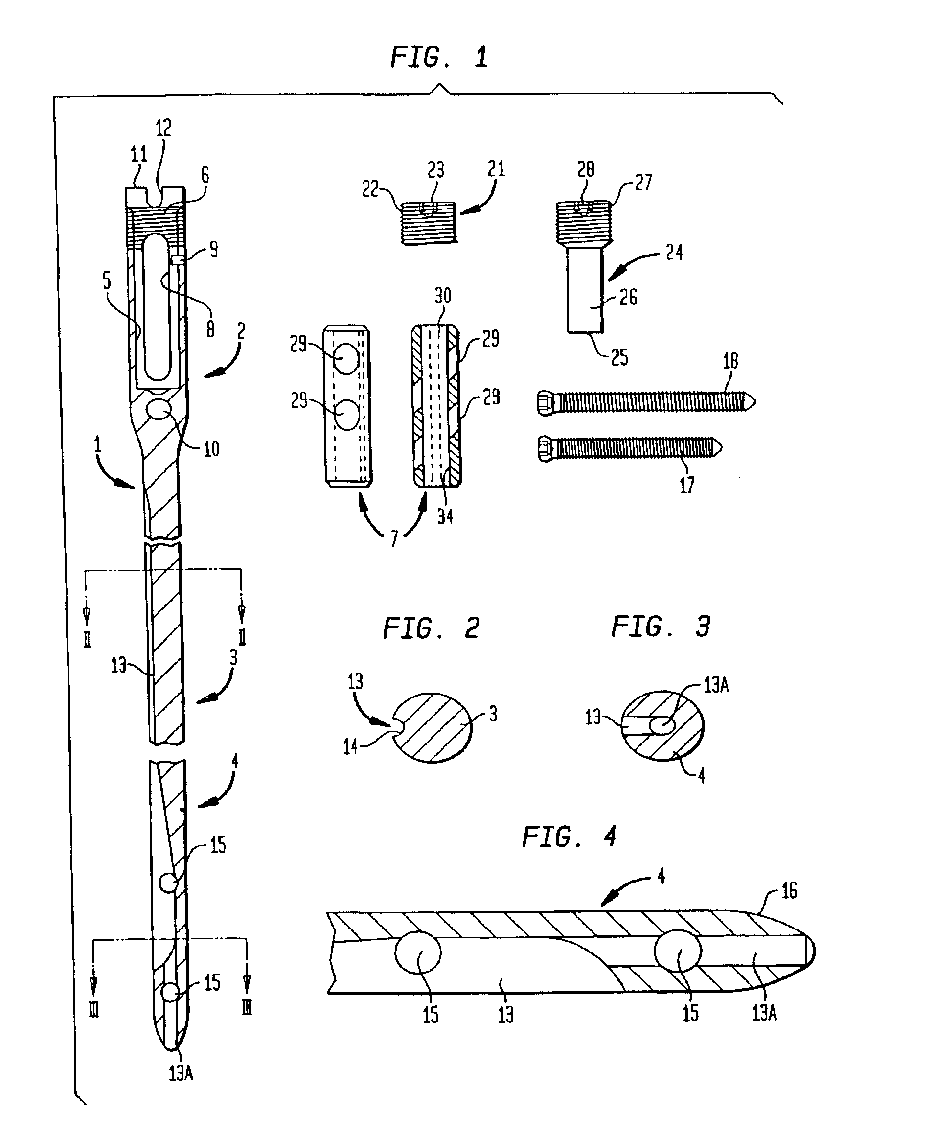 Modular intramedullary nail