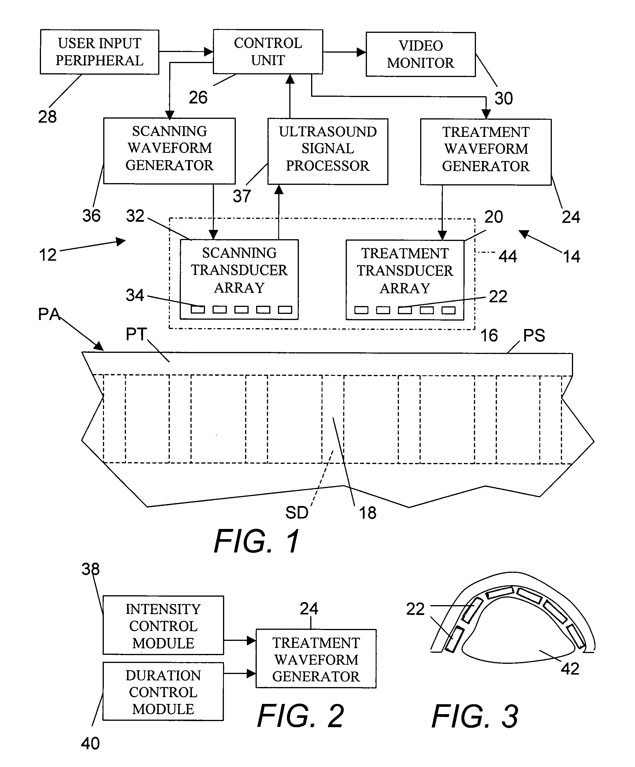 Spinal treatment method and associated apparatus