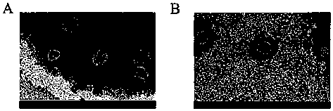 Docetaxel compound liposome, preparation method thereof and application of liposome