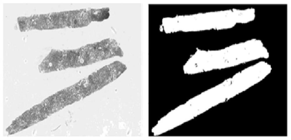 Glomerular cell image recognition method based on deep neural network