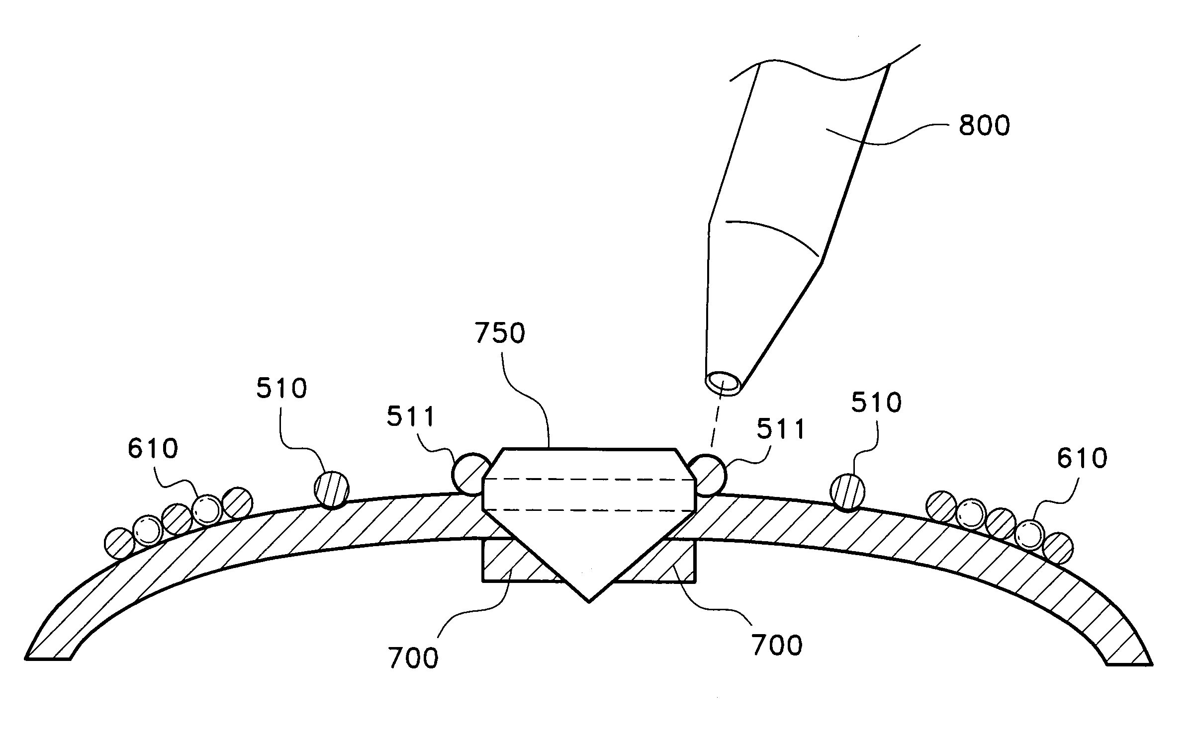 Method for metal ornamentation