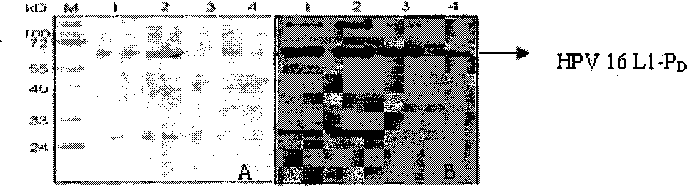 Viral capsid mosaic protein HPV16 L1-P&lt;D&gt;, preparation method and application thereof