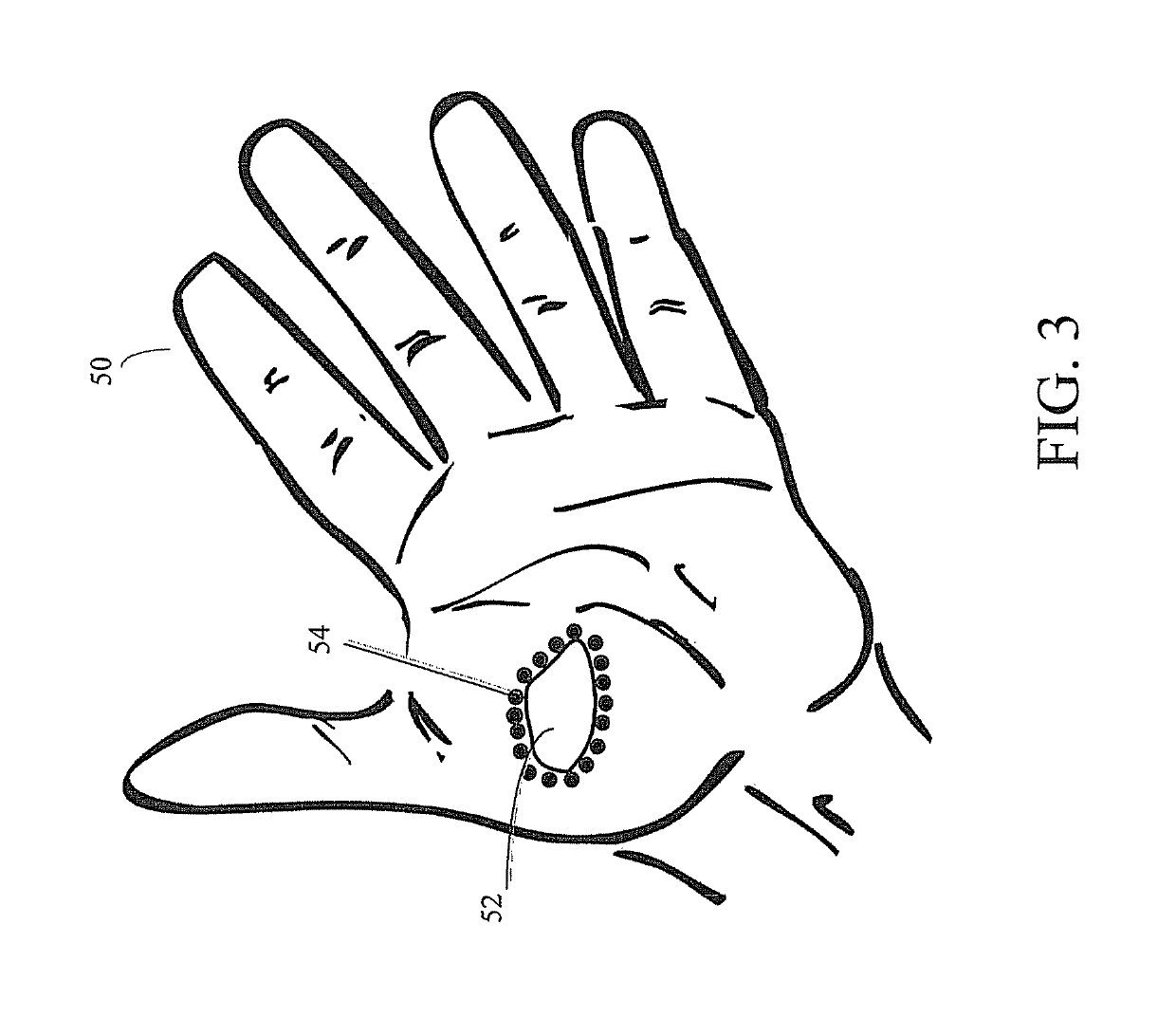 Expandable amnion membrane for treating non-healing wounds