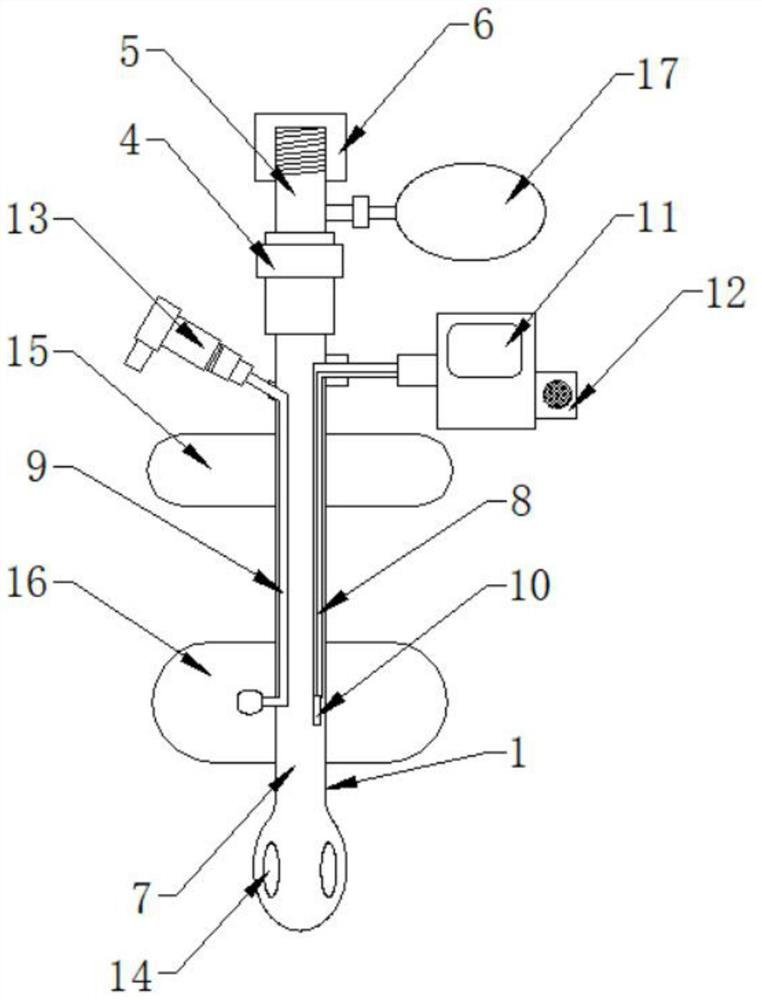 Multifunctional controllable bladder fistulization tube