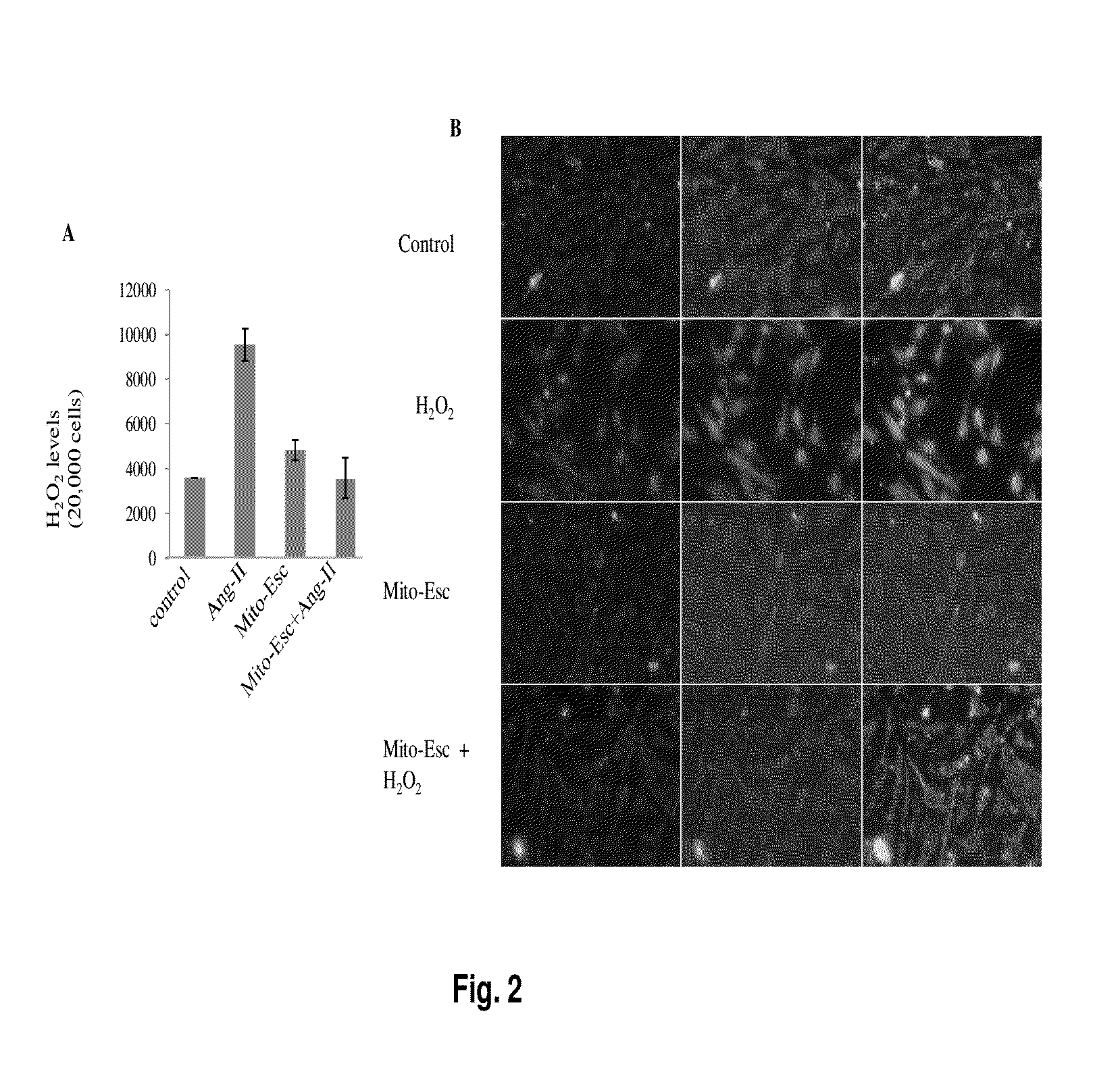 Antioxidant compound having anti atherosclerotic effect and preparation thereof