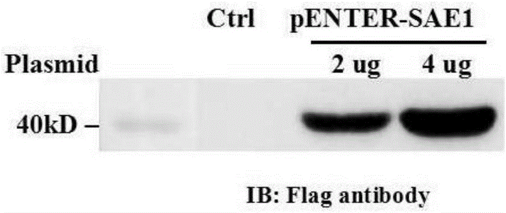 Inflammatory myopathy SAE1 self antibody non-radioactive detection method and application thereof