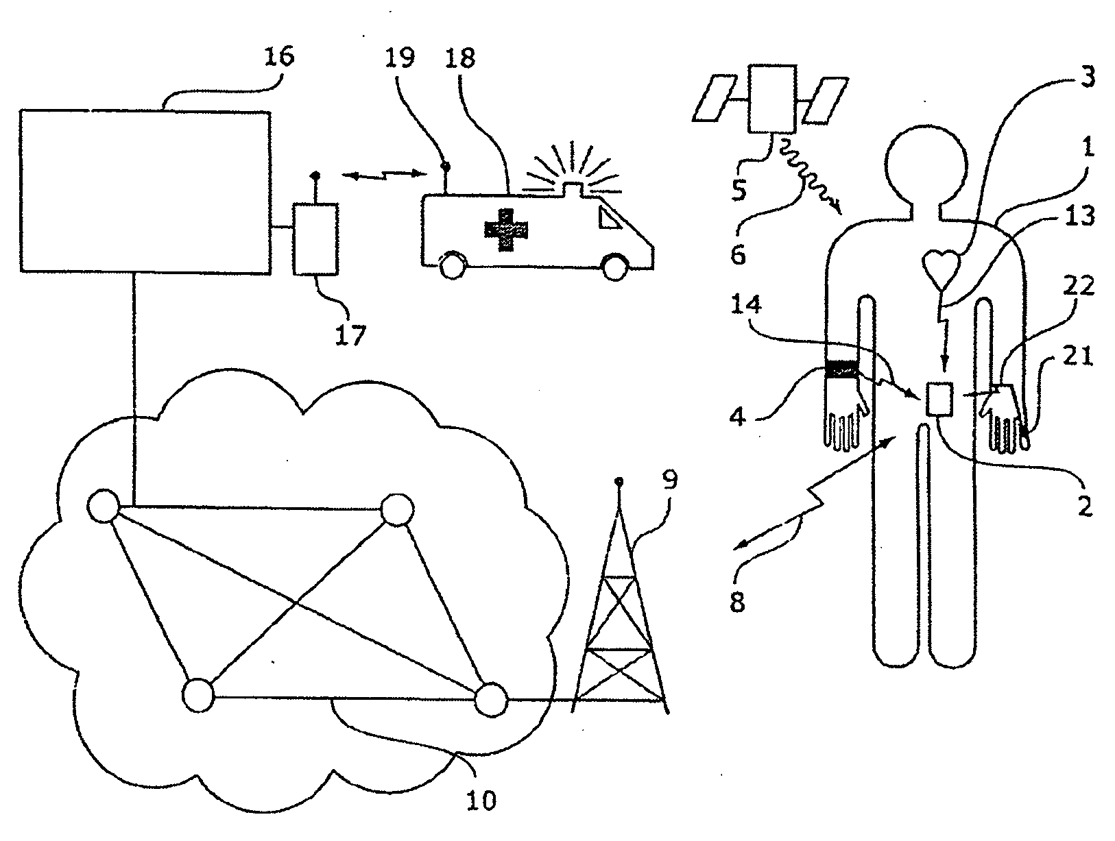 Patient monitoring system for the real-time detection of epileptic seizures