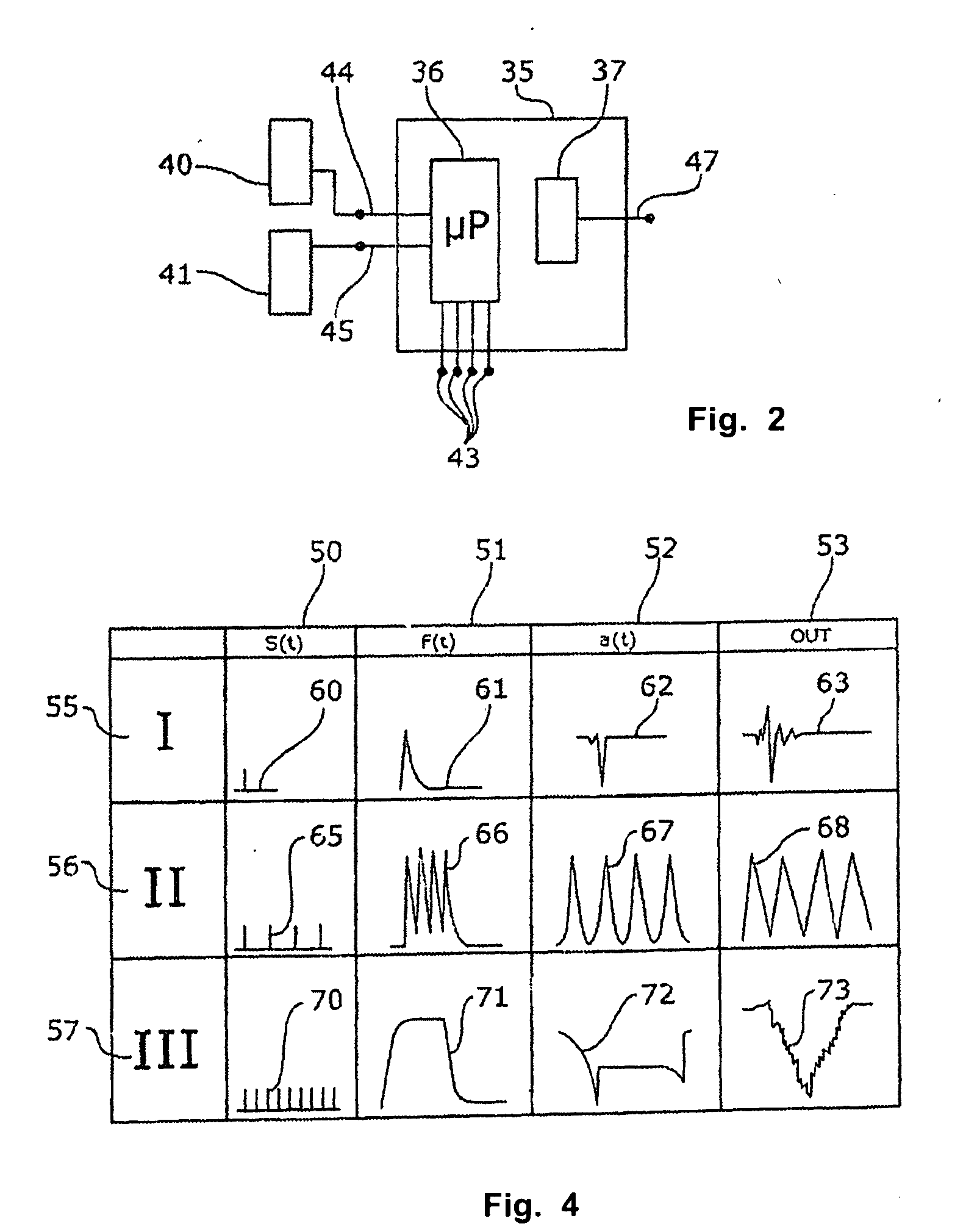 Patient monitoring system for the real-time detection of epileptic seizures