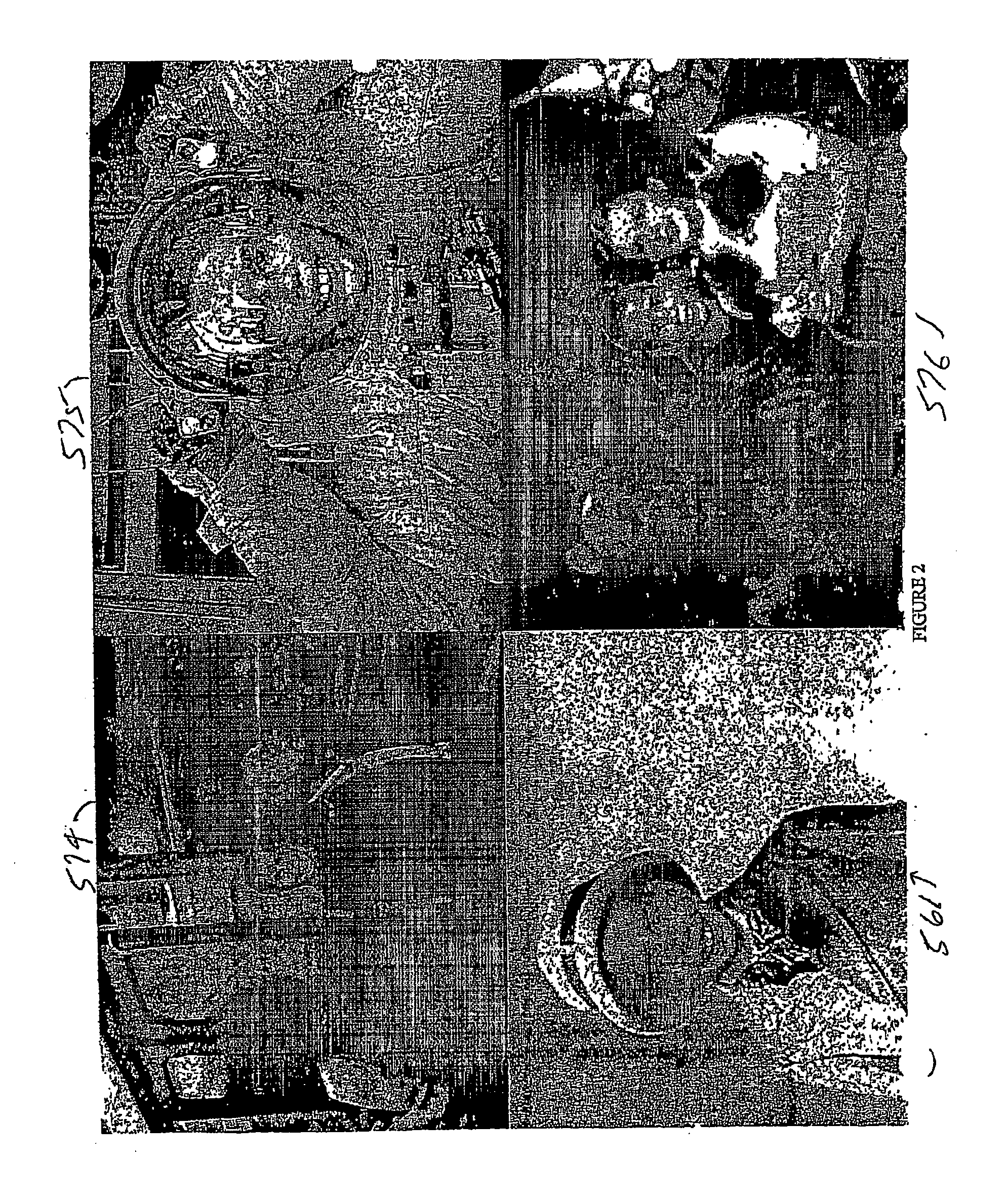 Digital Imaging Method and Apparatus