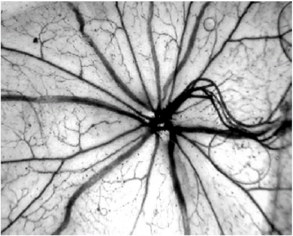 Application of specnuezhenide in preparation of medicine for treating neovascular diseases