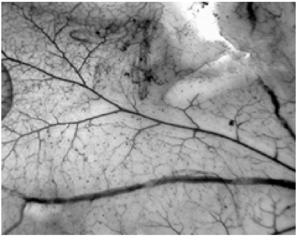 Application of specnuezhenide in preparation of medicine for treating neovascular diseases