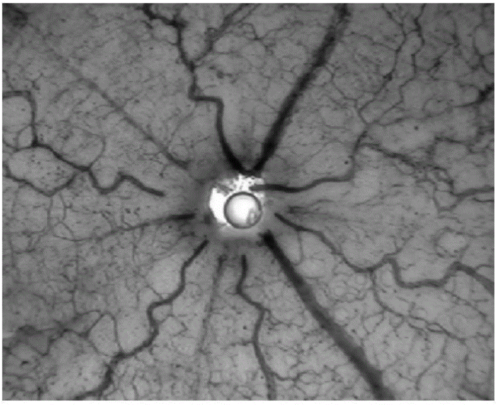 Application of specnuezhenide in preparation of medicine for treating neovascular diseases