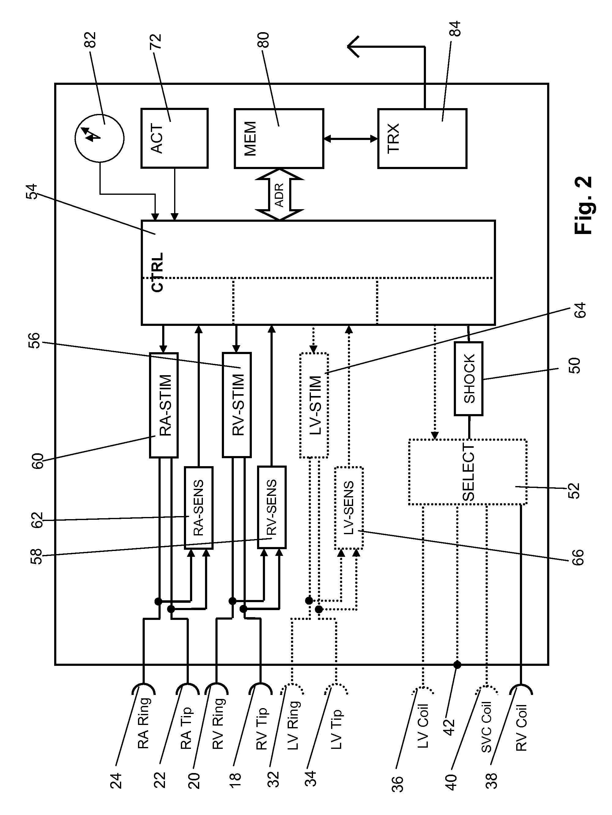 Antitachycardiac heart stimulator