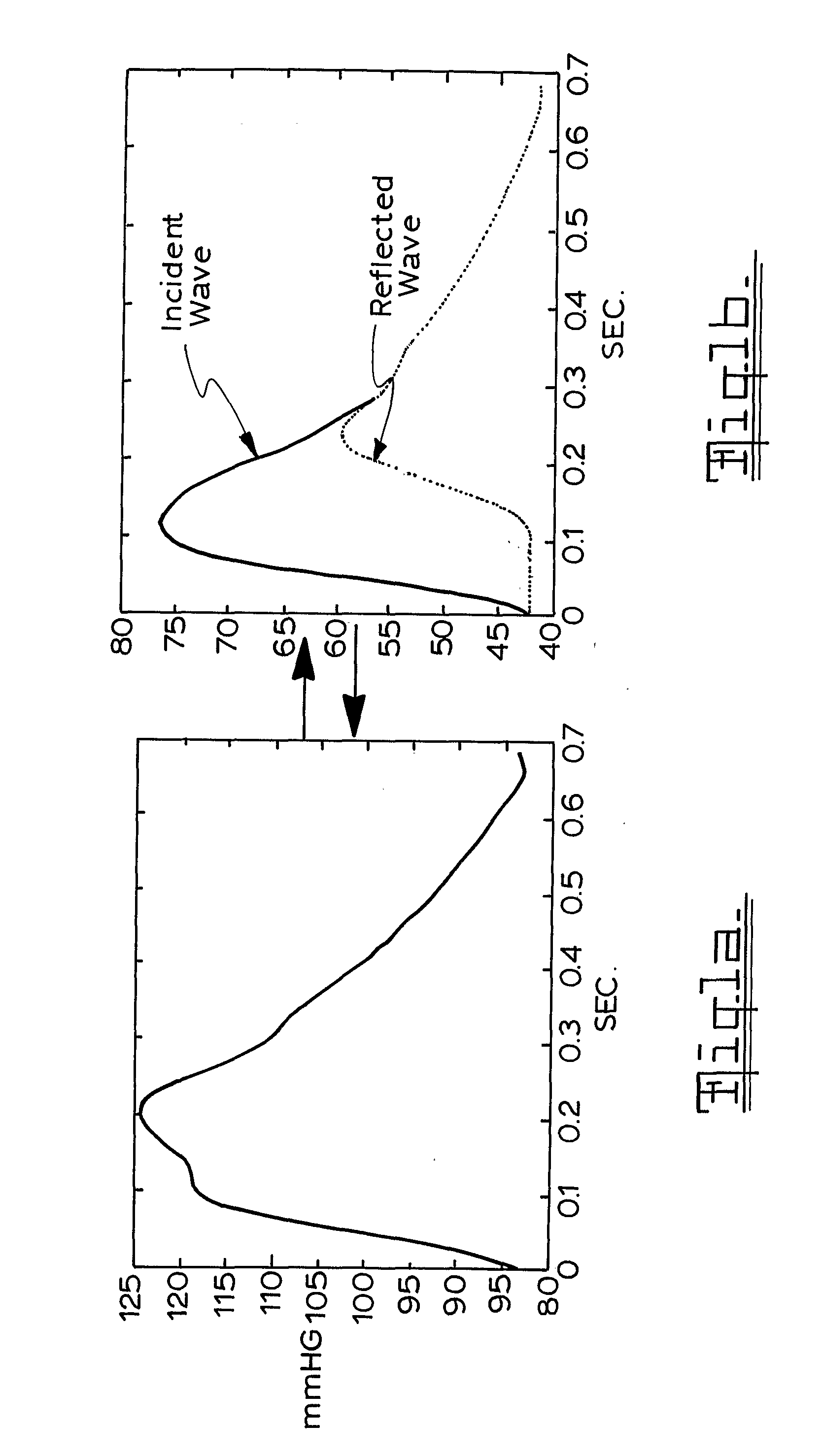 Method of estimating pulse wave velocity