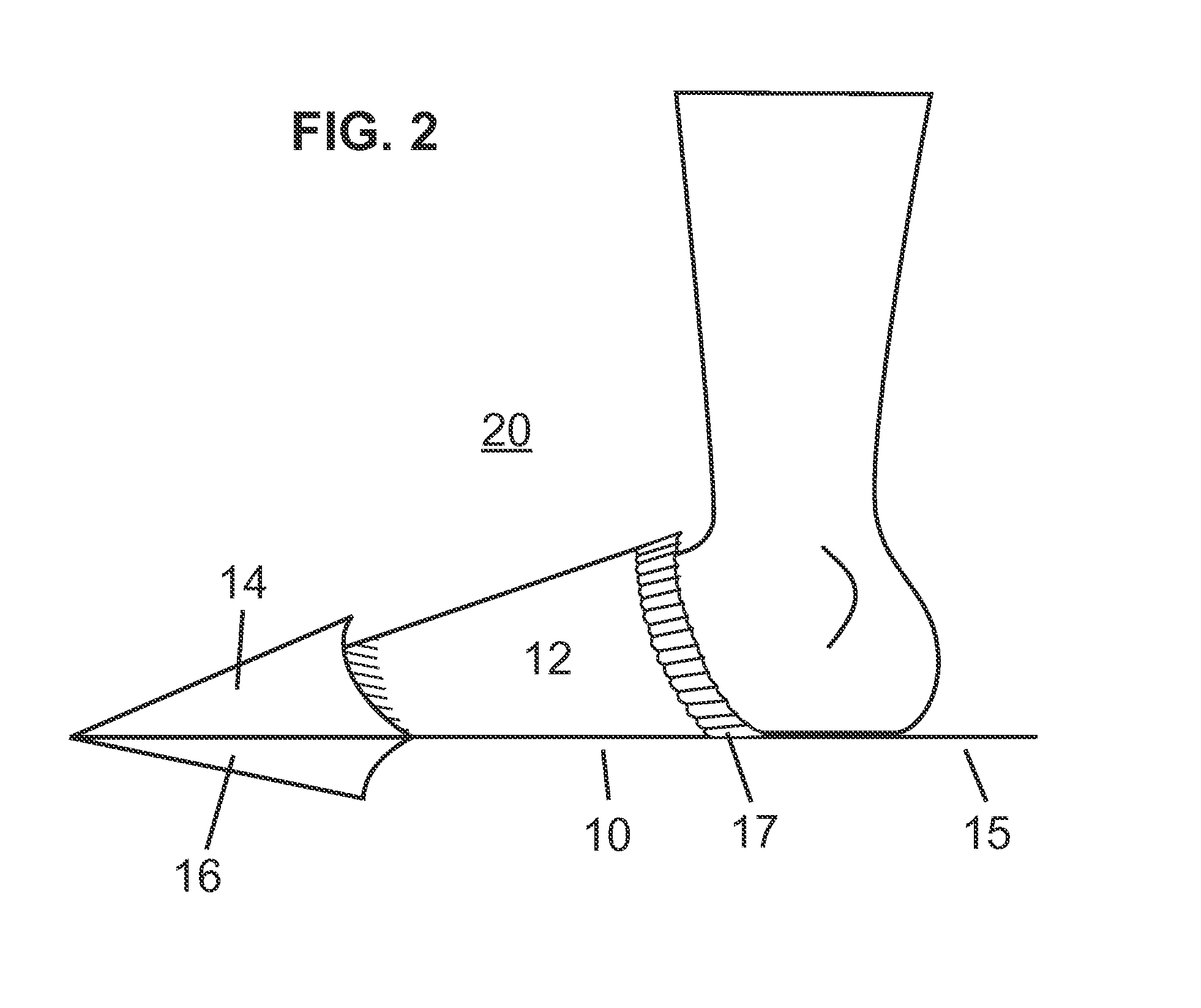 Wetsuit Entry Device and Method for Manufacturing