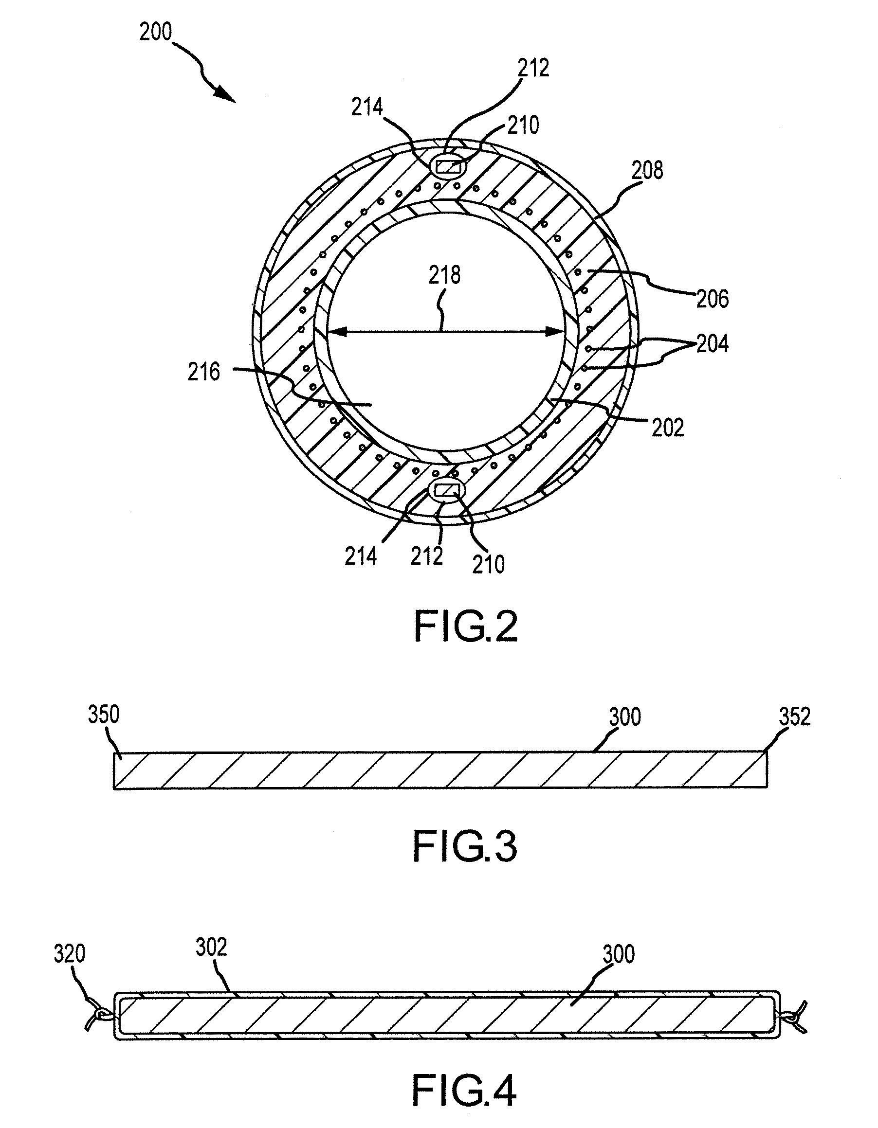 Catheter and method of manufacture