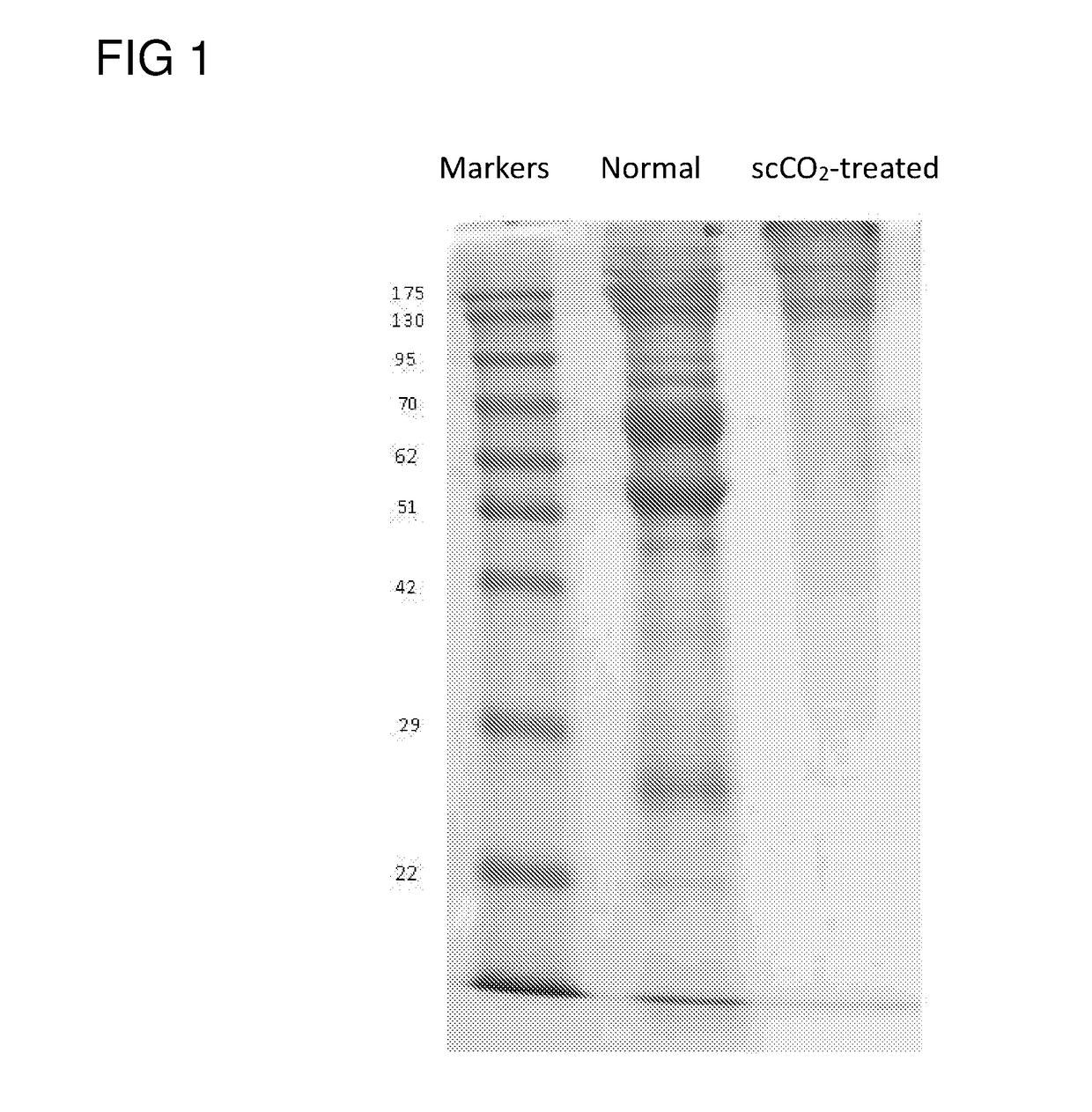 Acellular corneas, methods of producing the same and uses thereof