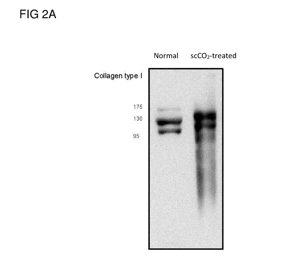 Acellular corneas, methods of producing the same and uses thereof