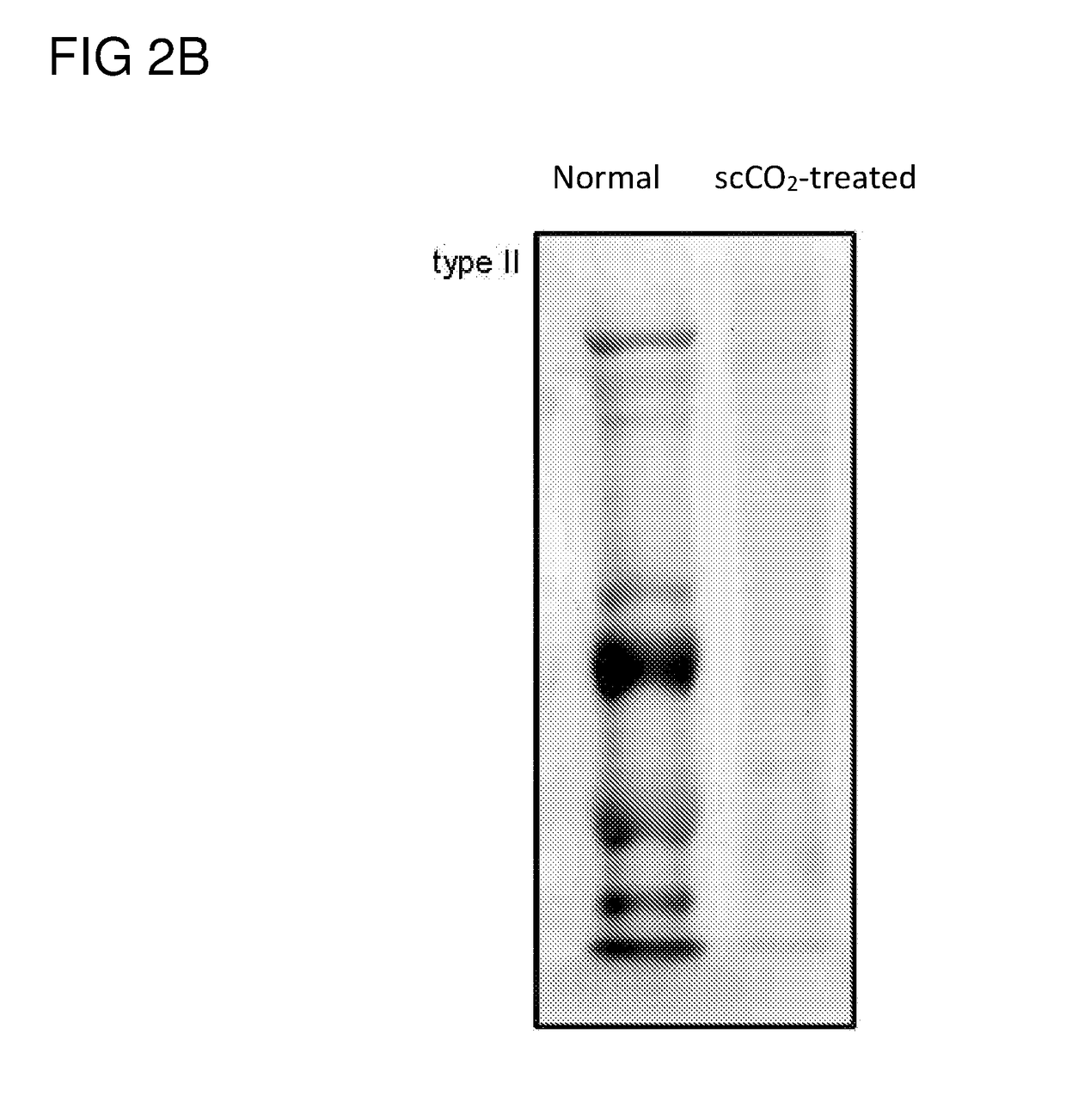 Acellular corneas, methods of producing the same and uses thereof