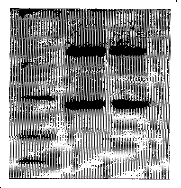 Method for purifying lysostaphin by antibody affinity chromatography