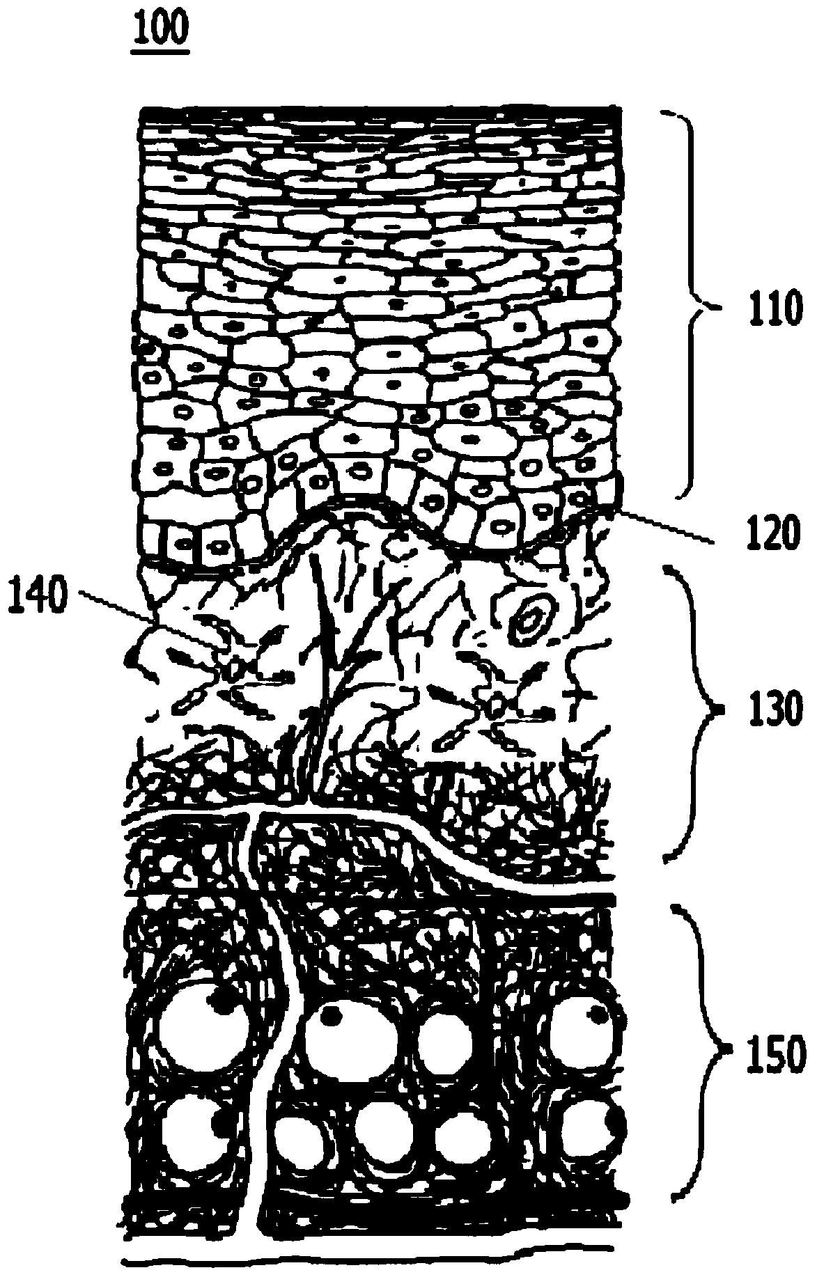 Soluble microneedle arrays for buccal delivery of vaccines