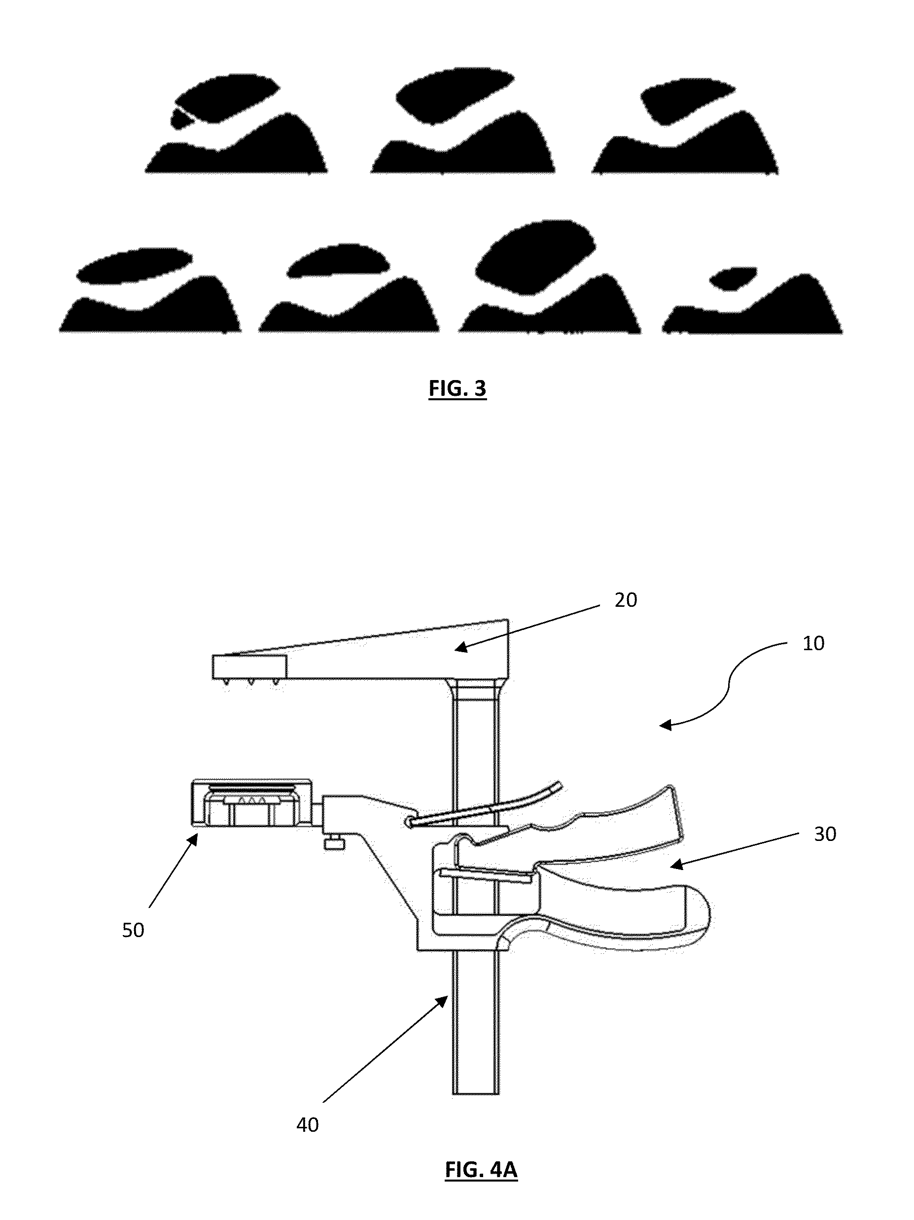 Patella Resection Instrument Guide Having Optional Patient-Specific Features