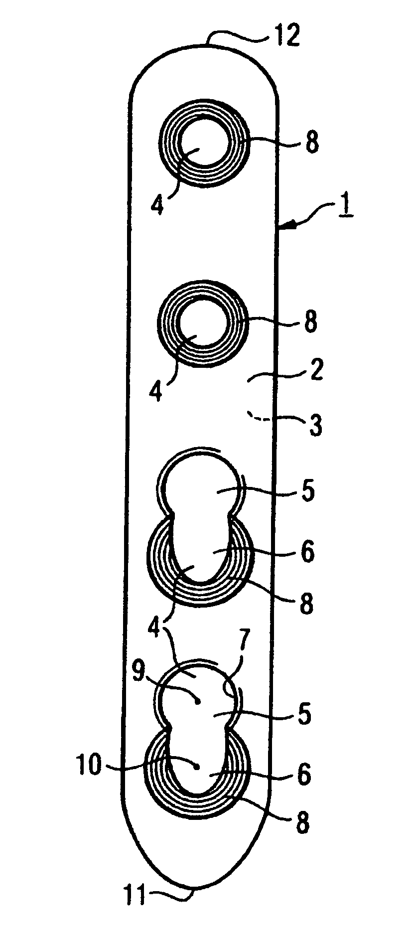 Bone plate